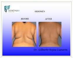 Slider image (4) Esthetique Clinic and Spa